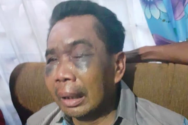 Polrestabes Medan Mulai Periksa Sarpan, Saksi Dianiaya Oknum Polisi Percut