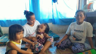 Photo of Bocah Penderita Hydrocephalus di Palas, Mengharapkan Batuan Dermawan Untuk Biaya Pengobatan