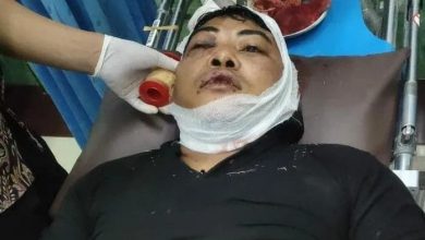 Photo of Satu Keluarga di Jalan Jermal XV Diserang, Anak dan Ayah Ditebas Parang