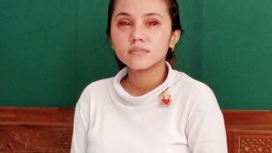 Photo of Mata Masih Merah, Pusing, hingga Dada Sesak akibat Gas Air Mata, Kesaksian Naswa Korban Tragedi Kanjuruhan