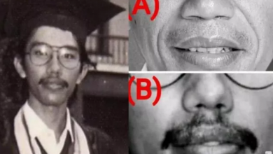 Photo of Pakai Ilmu Anatomi, Dokter Tifa Sebut Foto Wisuda Jokowi Tak Serupa: Hidung, Bibir, dan Gigi Dua Orang Berbeda