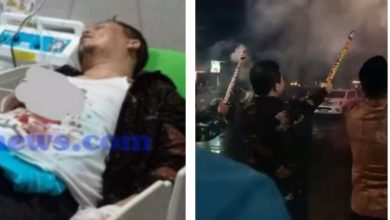 Photo of Petasan Meledak Ditangan saat Rayakan Malam Tahun Baru, Wakil Bupati di Bengkulu Jalani Operasi