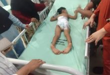Photo of Anak 5 Tahun Terpaksa Dilarikan ke RSUD Panyabungan Akibat Digigit Monyet Lampung