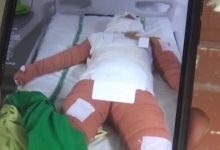 Photo of Perempuan di Deliserdang Dibakar Hidup-Hidup Eks Karyawan, Kondisinya Memilukan