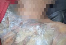 Photo of Warga Percut Sei Tuan Tewas Disiram Air Keras OTK